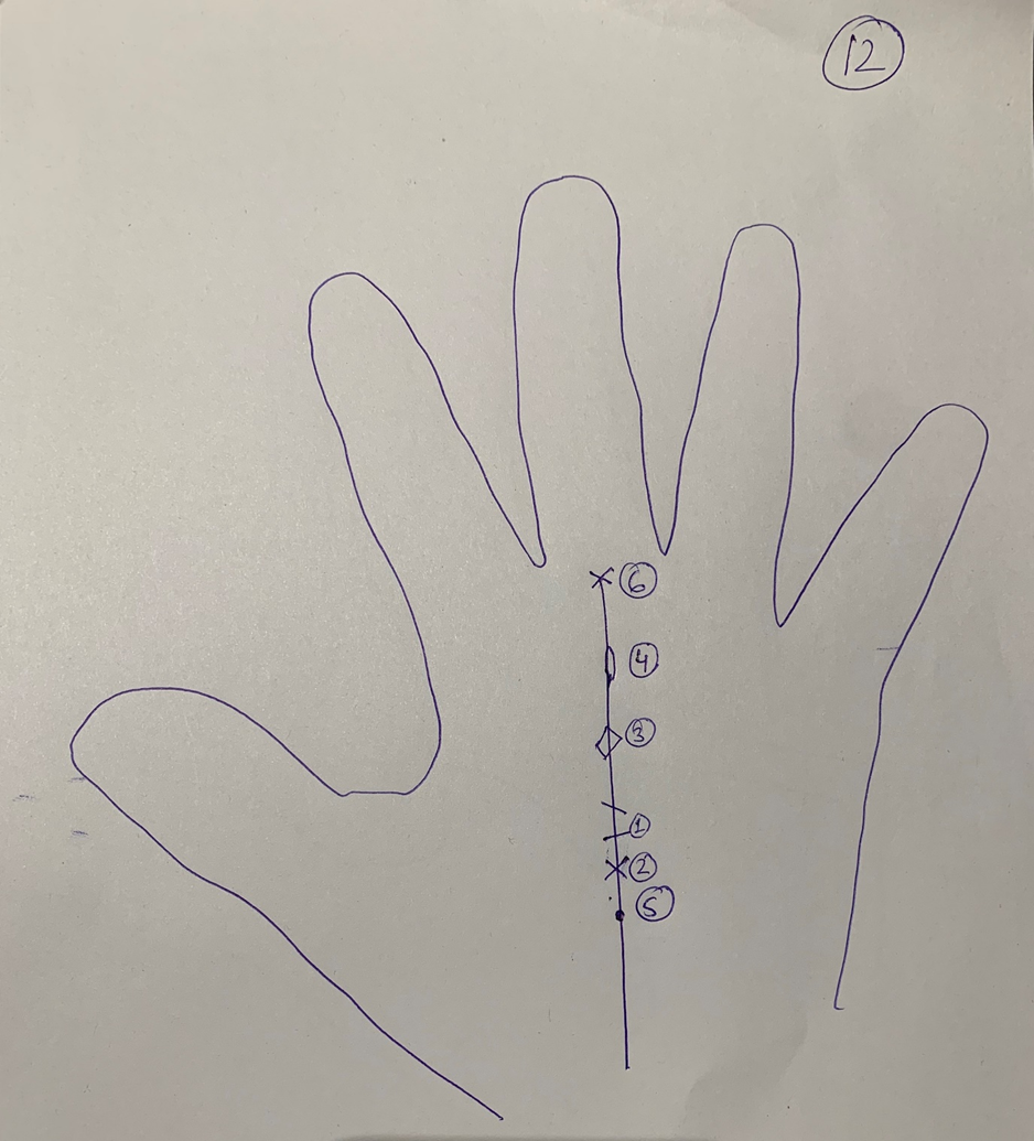 Hand-drawn palm outline with six numbered marks set along the vertical line — crosses, an island, a diamond, a bar and a dot