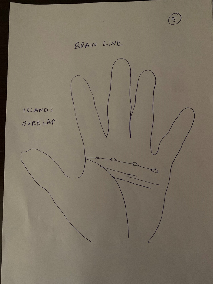 Hand-drawn palm headed "Brain line — islands, overlap", a chain of small oval islands strung along the head line with overlapping strands beneath it