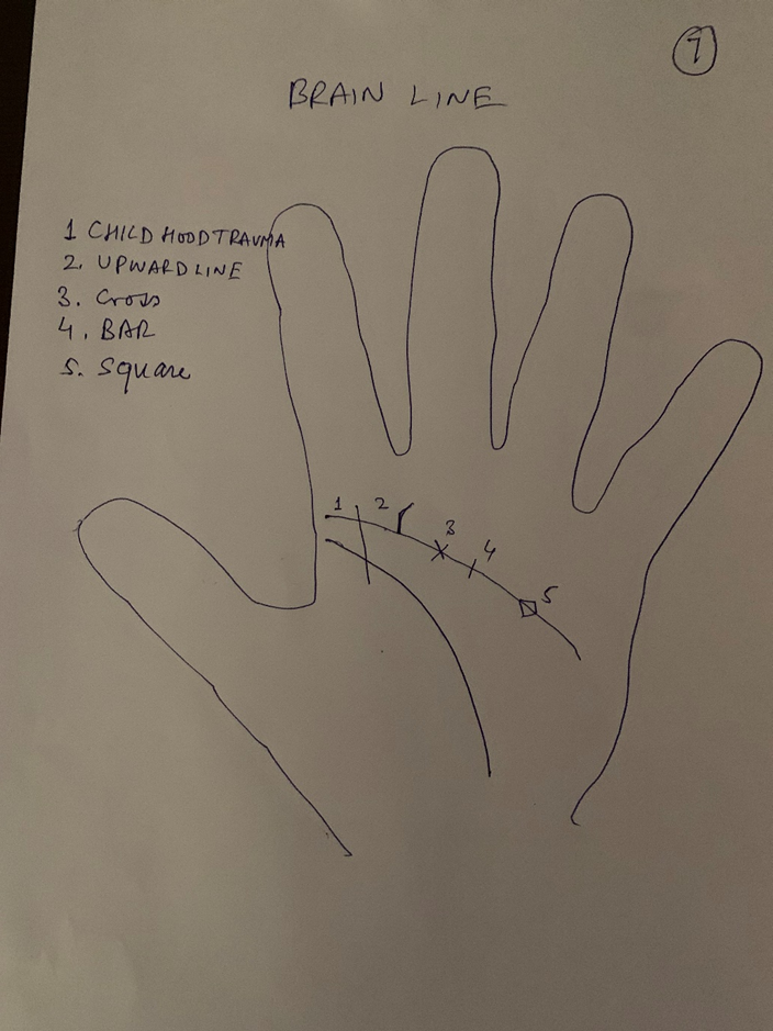 Hand-drawn palm headed "Brain line" with five numbered markings along it — childhood trauma, an upward line, a cross, a bar and a square