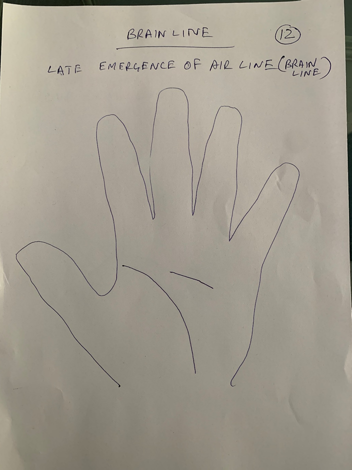 Hand-drawn palm headed "Brain line — late emergence of air line", the head crease beginning well out into the palm rather than at its edge