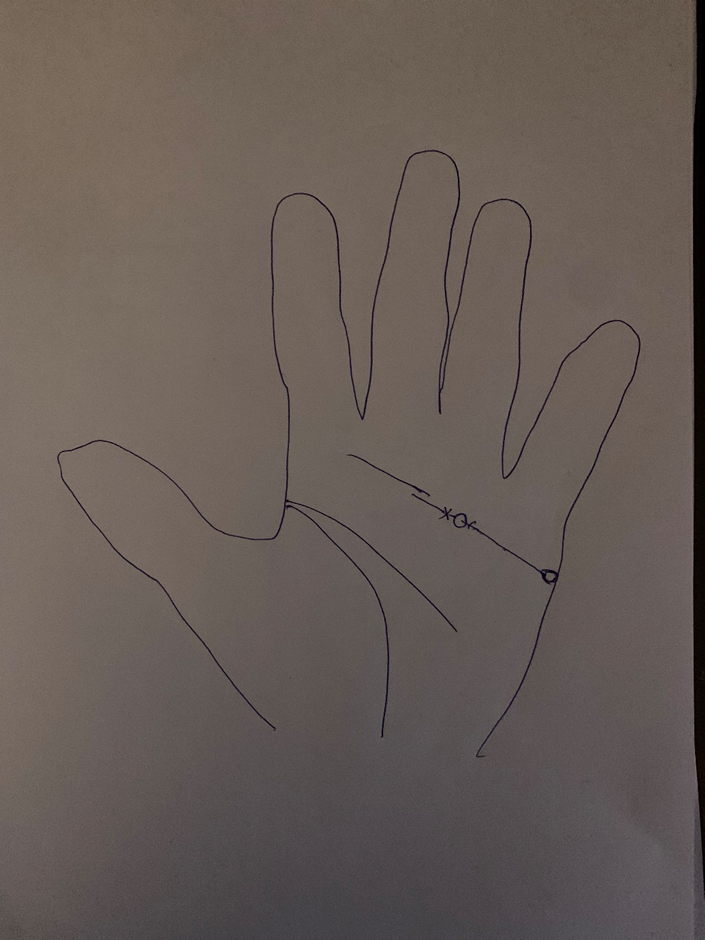 Hand-drawn palm with markings set along the heart line — a chained section, a cross, a circle and an island toward the palm edge