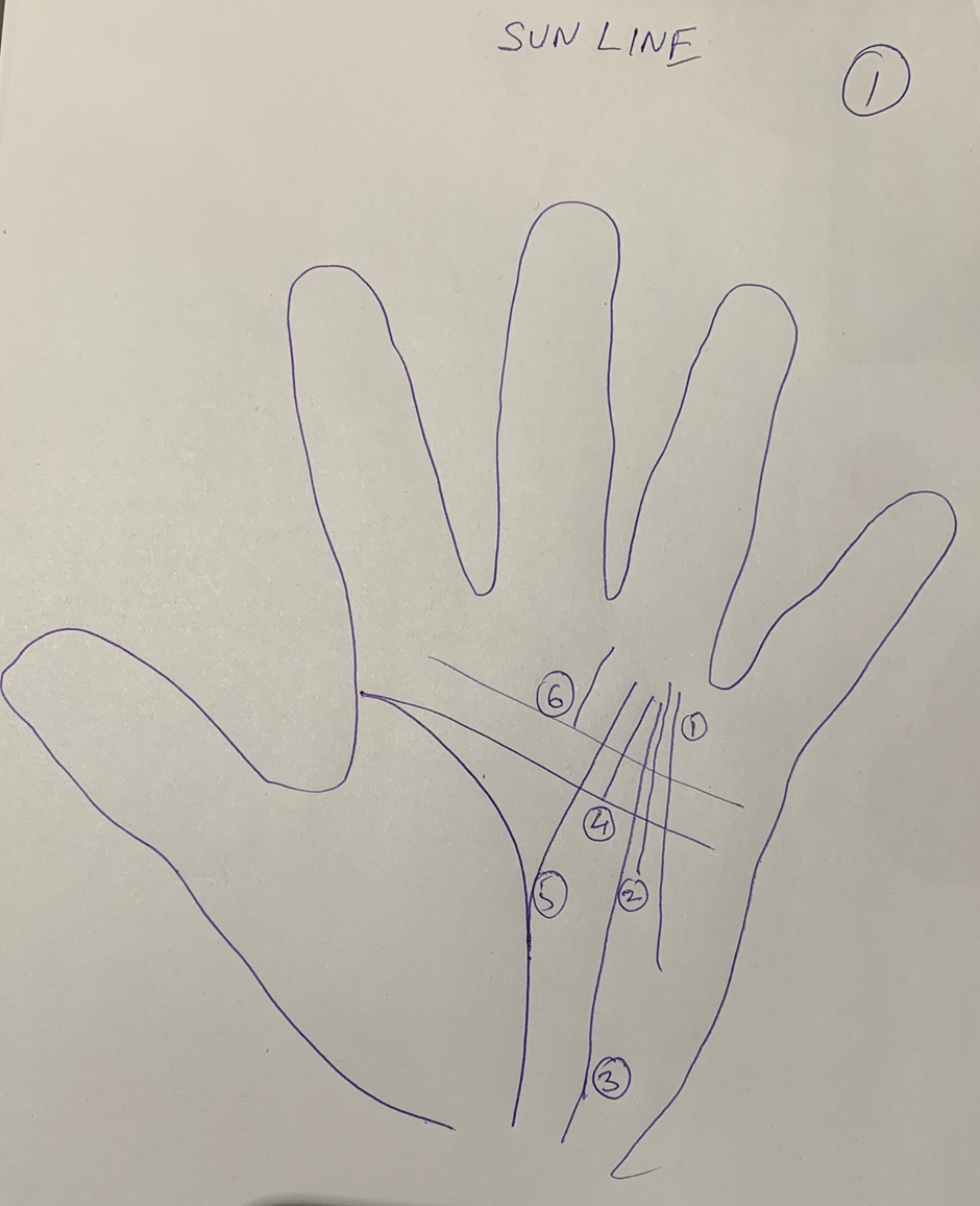 Hand-drawn palm headed "Sun line" with six numbered starting points marked, the lines rising from different depths of the palm toward the ring finger