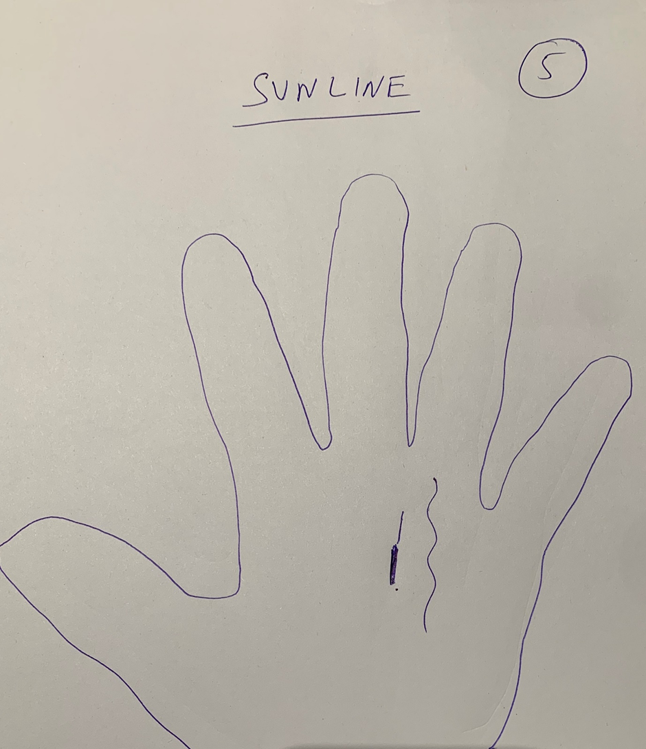 Hand-drawn palm headed "Sun line" comparing two short lines below the ring finger — one heavily inked and broken, the other drawn as a continuous ripple