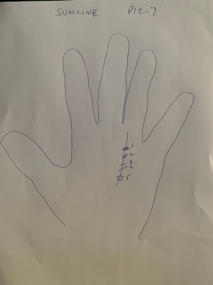 Hand-drawn palm headed "Sun line" with five numbered signs set along the line — two crosses, two bars and a square