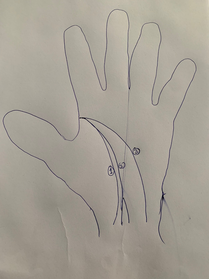 Hand-drawn palm with three numbered life-line trajectories from a common origin — one hugging the thumb, one mid-palm, one sweeping wide toward the wrist