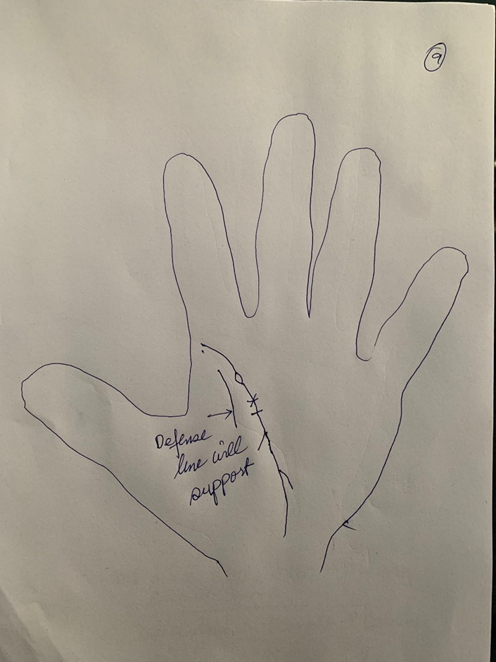 Hand-drawn palm annotated "defense line will support", with an island, crosses and short bars marked along the life line and a parallel line inside it