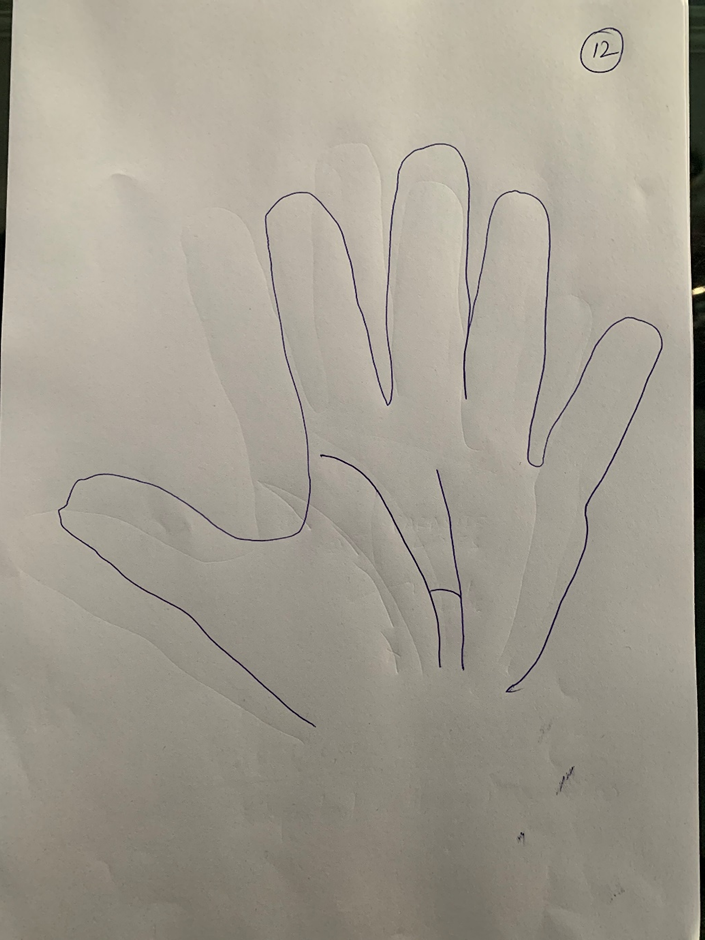 Hand-drawn palm where the life line curves down and joins the vertical fate line low in the palm