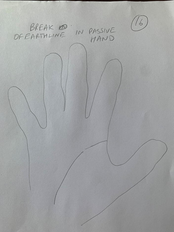 Hand-drawn palm captioned "Break of earth line in passive hand", the life line interrupted partway down