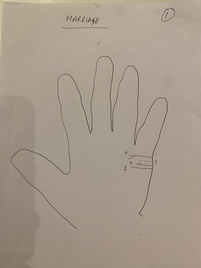 Hand-drawn palm headed "Marriage", four numbered short lines drawn on the edge of the palm below the little finger