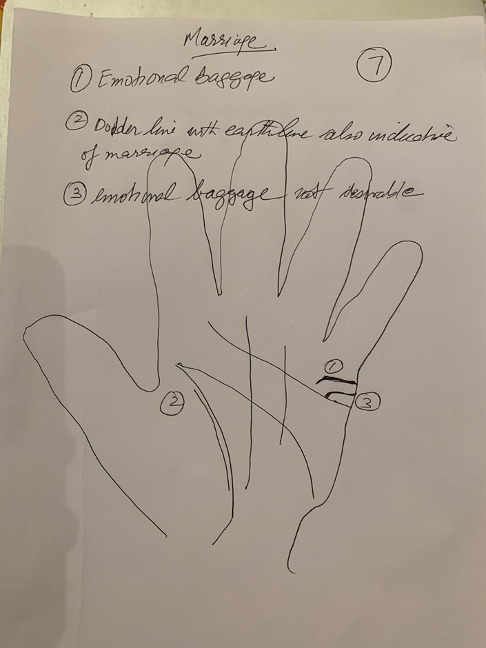 Hand-drawn palm headed "Marriage" with three numbered features — emotional baggage marked twice on the palm edge, and a doubled line beside the earth line