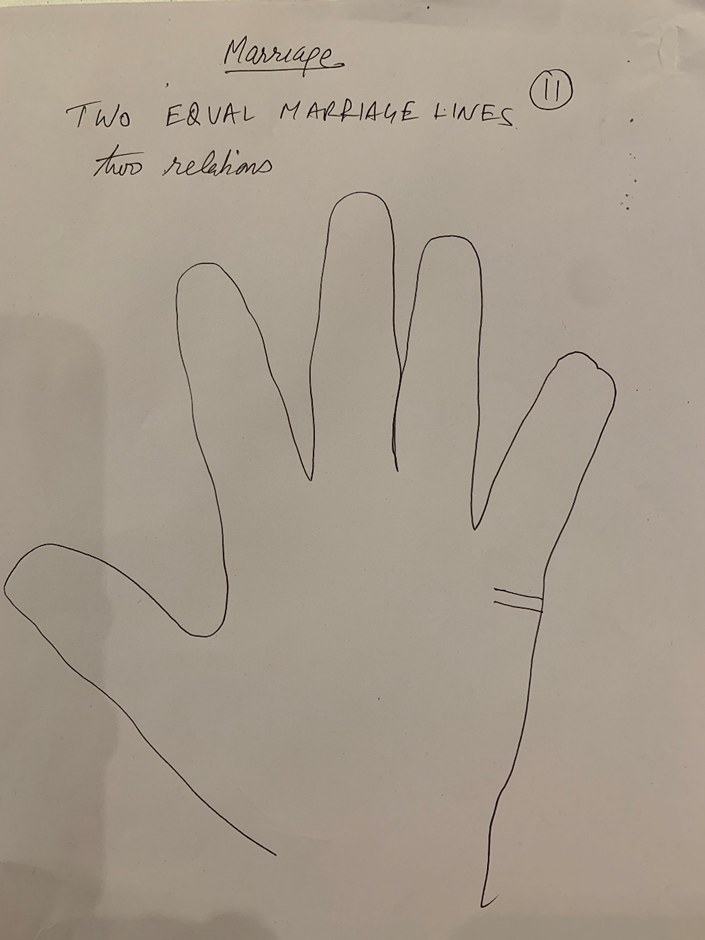 Hand-drawn palm captioned "Two equal marriage lines — two relations", a pair of parallel strokes on the palm edge below the little finger