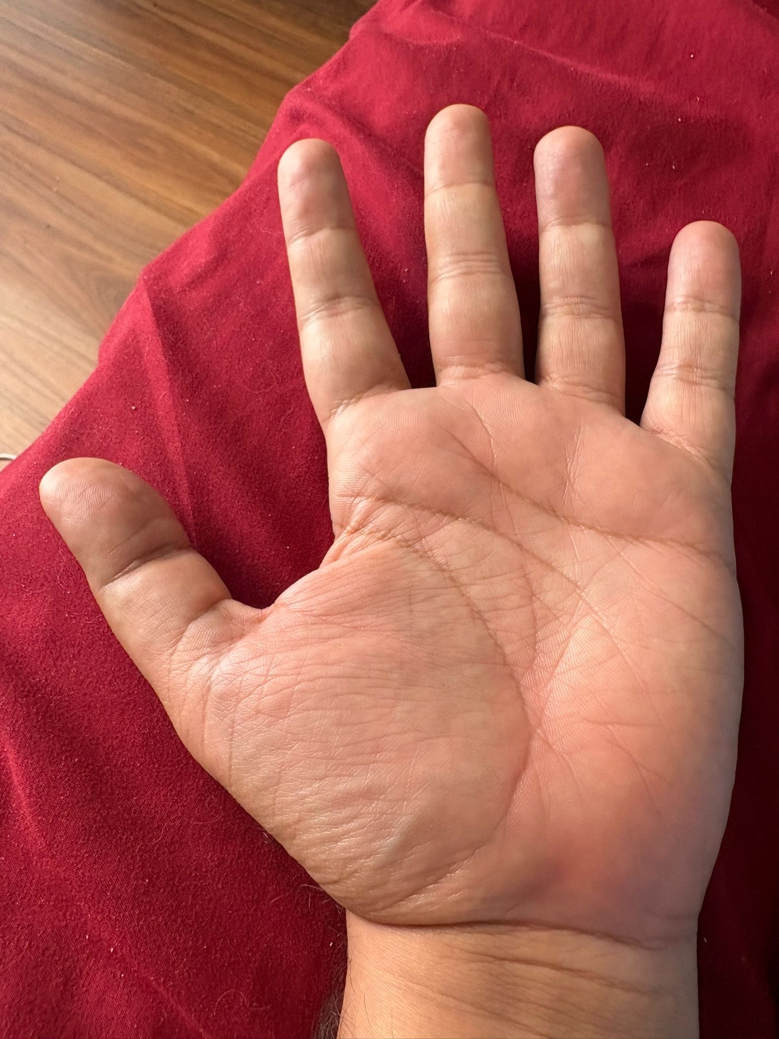 Photograph of a left palm held open, showing its natural line pattern