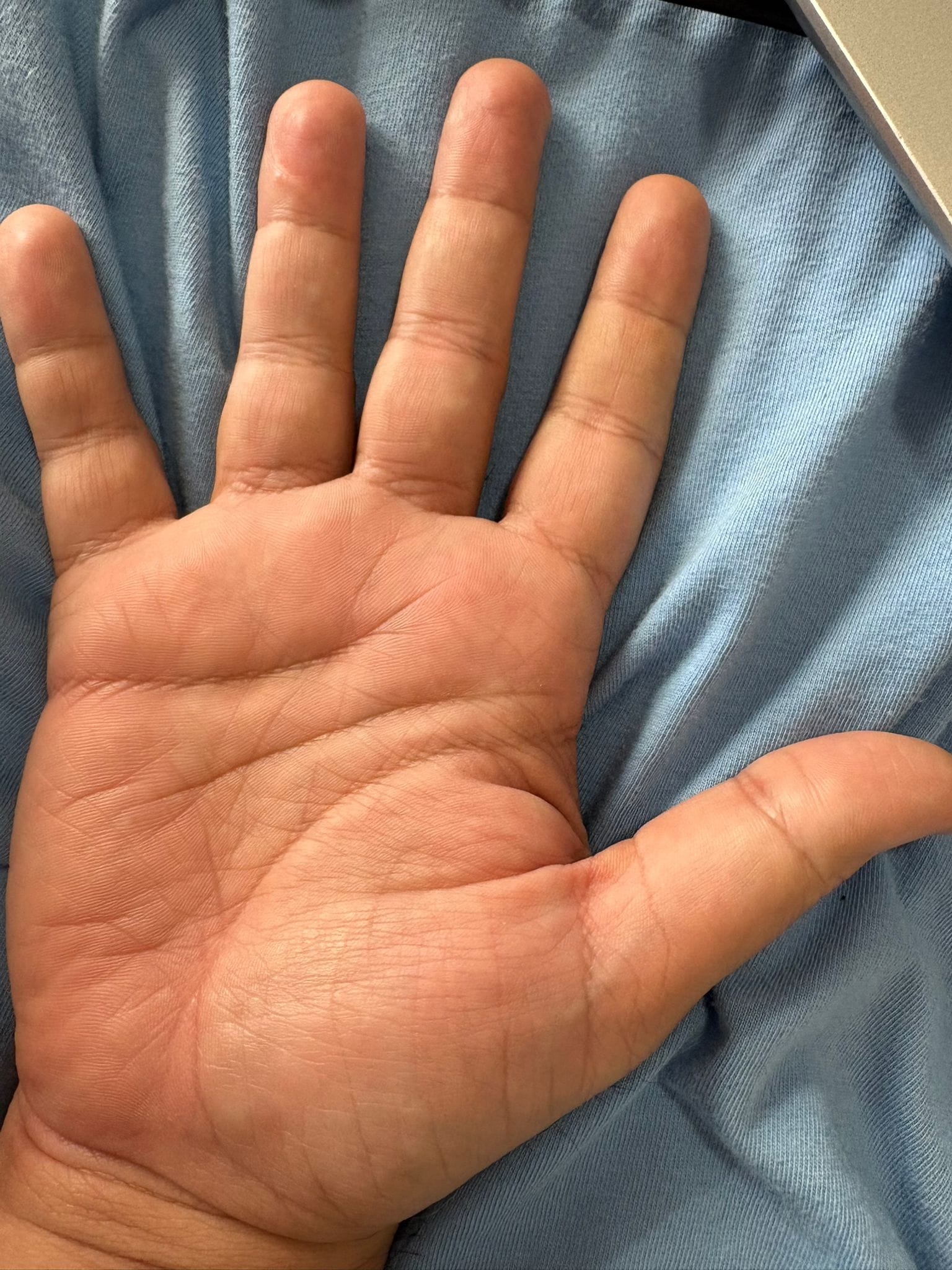 Photograph of a right palm held open, showing its natural line pattern